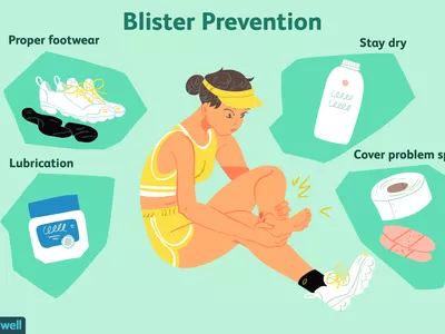 Blister prevention